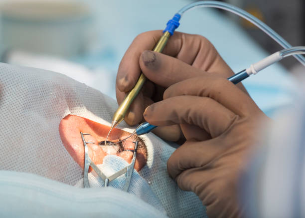 Best Phacoemulsification Surgery Doctor in Naupada, Thane